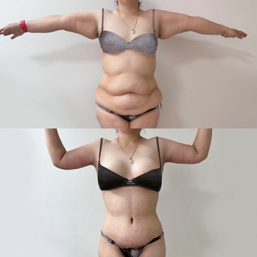 Slider image (6) Dr. Gabriel Sandoval - Plastic Surgeon in Mexico